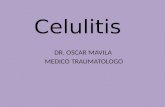 Celulitis  i