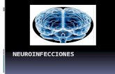 Neuroinfecciones parte 1