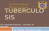 Tuberculosis pulmonar patología