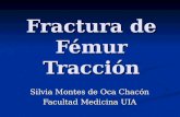 Fractura de femur - Tracción