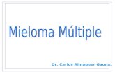 Mieloma múltiple y macroglobulinemia de Waldenstrom