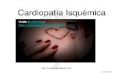 Cardiopatía Isquémica: Angina de pecho, Infarto de miocardio, Muerte subita
