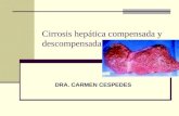 Cirrosis hepatica compensada y descompensada