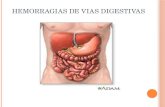 Hemorragias vias digestivas