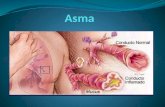 Asma presentacion