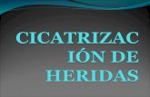 CICATRIZACIÓN DE HERIDAS
