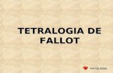 TETRALOGIA DE FALLOT