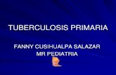 Tuberculosis primaria en Pediatría.
