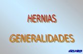 generalidades Hernias