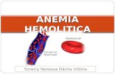 Anemia Hemolitica FINAL
