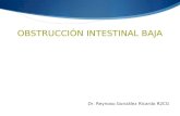 Obstrucción Intestinal Baja