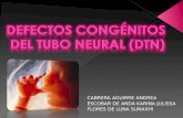 Defectos Congénitos del Tubo Neural