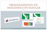 PROCESAMIENTO DIGITAL DE IMÁGENES CON MATLAB