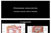 Procesos vasculares