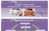 Pre Cancer - Cancer Melanoma
