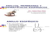 ANILLOS, MEMBRANAS Y DIVERTÍCULOS ESOFÁGICOS1