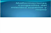 51439915 Malformaciones as Del Mienbro Superior y Mano
