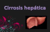 Cirrosis hepática.pdf