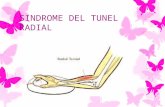 Sindrome Del Tunel Radial