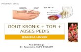 Gout Kronik + Tofi + Abses Pedis