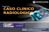Caso Clinico radiologico - Sd boerhaave