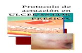 Protocolo de Actuacion de Ulceras Por Presion