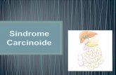 Sindrome Carcinoide