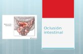 Oclusión intestinal