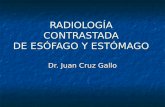 180 - Radiografías con contraste de esofago y estomago