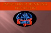Patologia benigna de colon