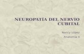 Neuropatía del nervio cubital y radial