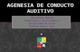 Agenesia de Conducto Auditivo