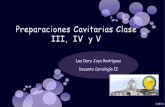 Preparaciones cavitarias tipo_iii_iv_y_v_ultima_pdf