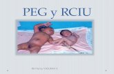 RCIU y PEG