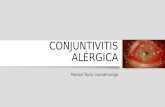 Conjuntivitis alergica   marisol