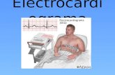 Electrocardiograma dhtic