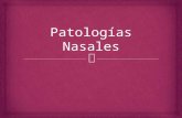 Patologías Nasales