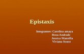 Epistaxis Us(2)