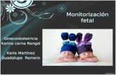 Monitorizacion fetal