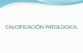 Calcificación patologica