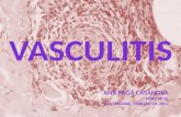 Vasculitis sesion para ap 1