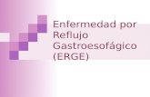 Enfermedad por reflujo gastroesofagico (erge)