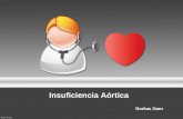 Insuficiencia aortica