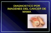Diagnostico por imagenes del cancer de mama