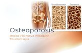 Osteoporosis Trauma