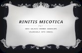 Rinitis micotica