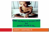 Desnutricion - pediatria