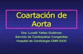 Coartación de aorta