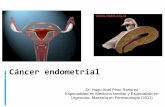 Cáncer endometrial