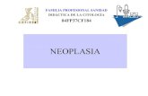 Neoplasia conceptos básicos